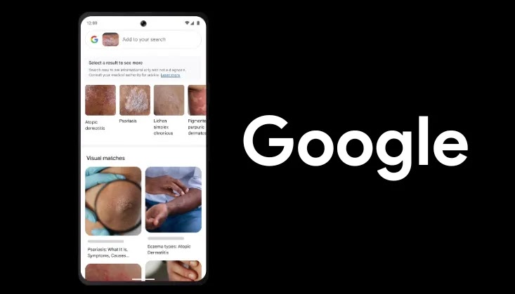 Google20lens201